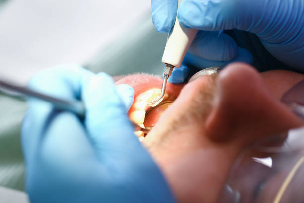 Best Walk-In Emergency Dental Services in Hickory Hls, IL