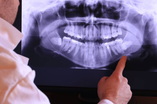 Best Emergency Root Canal Therapy in Hickory Hls, IL
