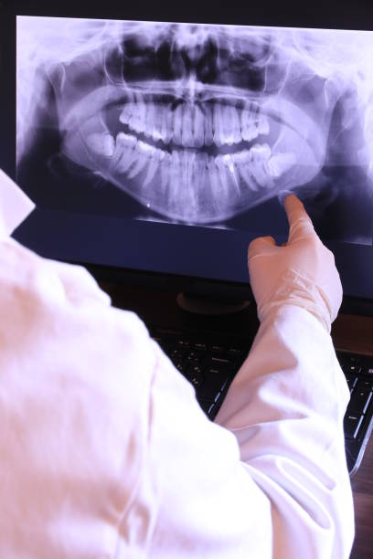Best Emergency Dental Care for Sports Injuries in Hickory Hls, IL
